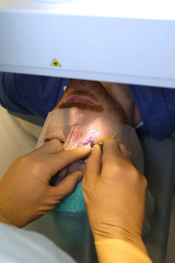 a propos centre monticelli paradis d ophtalmologie chirurgie refractive cornee marseille